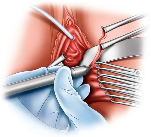 Cirugía íntima femenina Cirugía íntima femenina