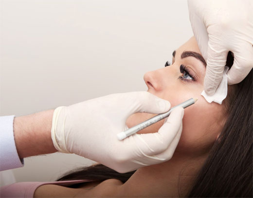 Aplicaci&oacute;n de &aacute;cido hialur&oacute;nico.