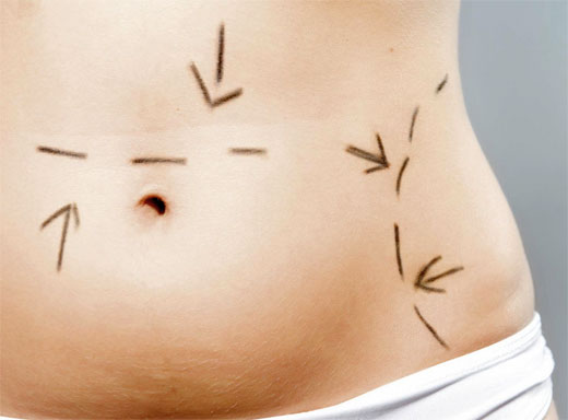 OTO&Ntilde;O CIRUGIA ESTETICA