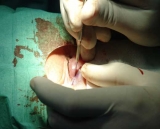 La blefaroplast�a, una pr�ctica que aumenta entre los hombres