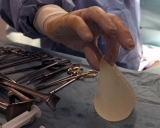 La vida de implantes y pr�tesis despu�s de la muerte