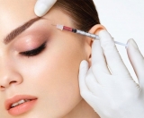 Aplicaciones del plasma rico en plaquetas en medicina est�tica